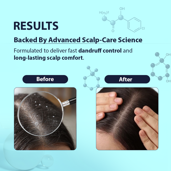 Dermistry Anti-Dandruff Shampoo | Piroctone Olamine