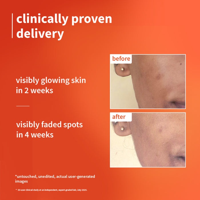 Plum 1% Vitamin C Ultra Light Glow Boosting Gel Cream