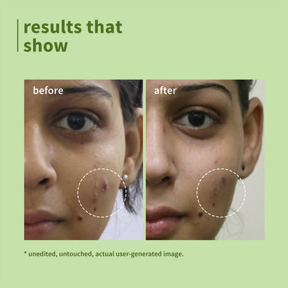 Plum Green Tea Pore Cleansing Face Wash For Oily & Acne Prone Skin