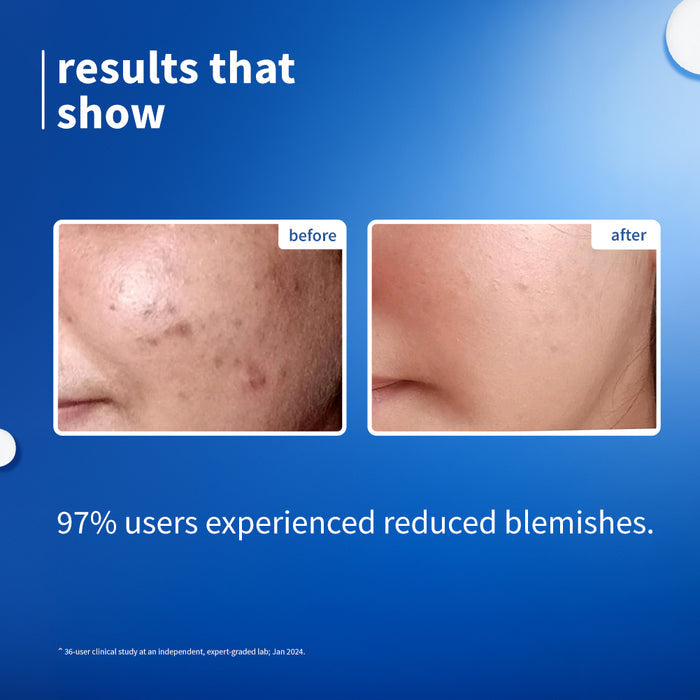 Plum 10% Niacinamide & Rice Water Brightening Face Serum