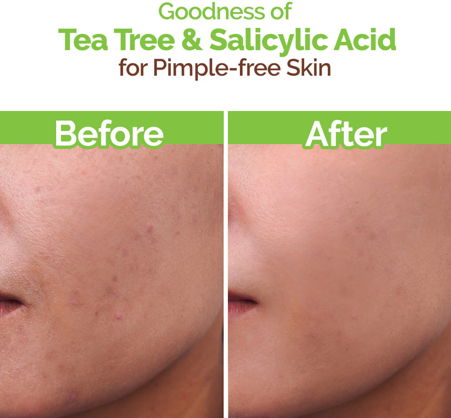 MamaEarth-Tea-Tree-Natural--for-Acne-&-Pimples-Removal-with-Neem-Face-Wash