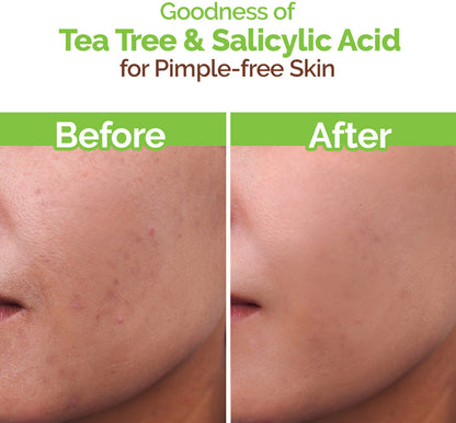 MamaEarth-Tea-Tree-Natural--for-Acne-&-Pimples-Removal-with-Neem-Face-Wash