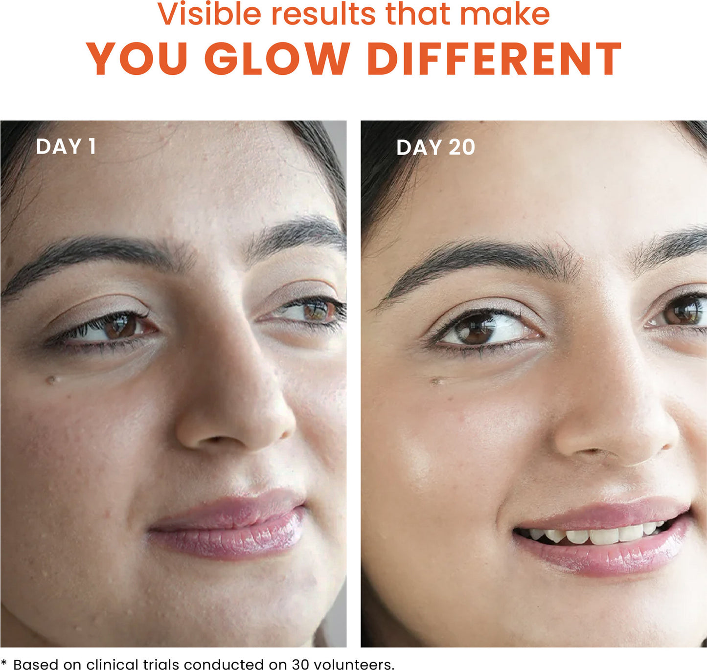 Foxtale Glow Toner & Setting Spray with Vitamin C & Niacinamide – 150 ml