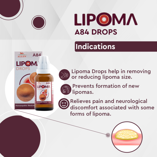 Allen A84 Lipoma Drop 30 ml