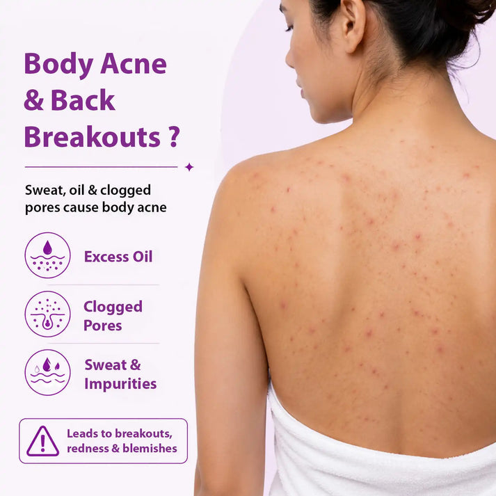 Dermistry Acne Control Body Wash for Clear | Healthy Skin