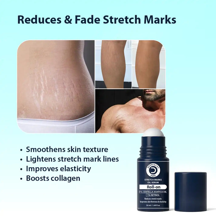 Dermistry Stretch Mark Serum with Retinol & Centella Asiatica 