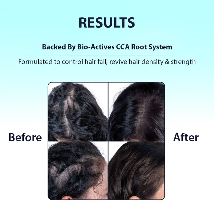 Dermistry Hair fall control hair mask treatment