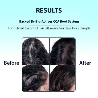 Dermistry Hair fall control hair mask treatment