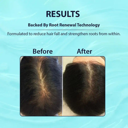 Dermistry Hair Fall Control Serum with Follicusan & Hairgenyl