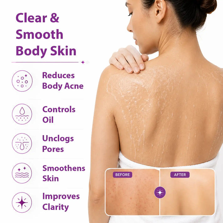 Dermistry Acne Control Body Wash for Clear | Healthy Skin