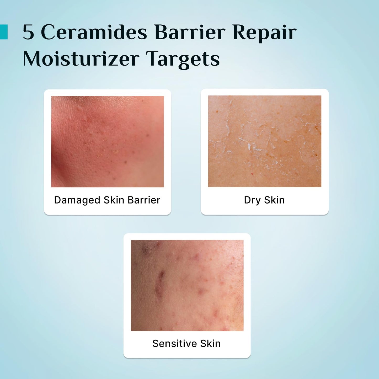 Pilgrim 5 Ceramides Barrier Repair Moisturizer With Korean Cica