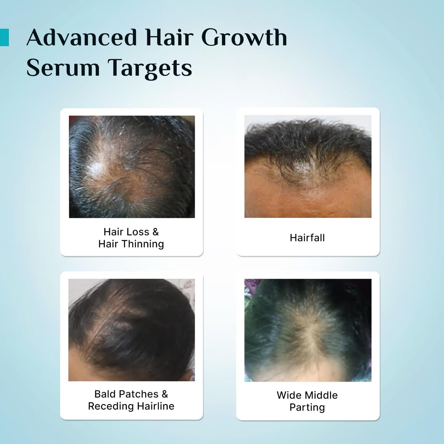 PILGRIM Redensyl 3%+Anagain 4% Advanced Hair Growth Serum
