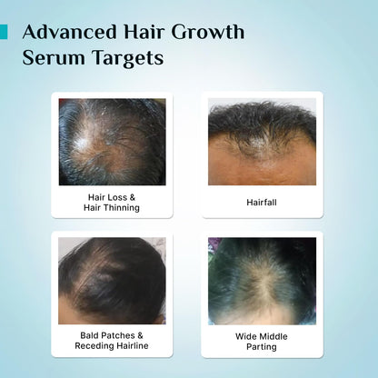 PILGRIM Redensyl 3%+Anagain 4% Advanced Hair Growth Serum