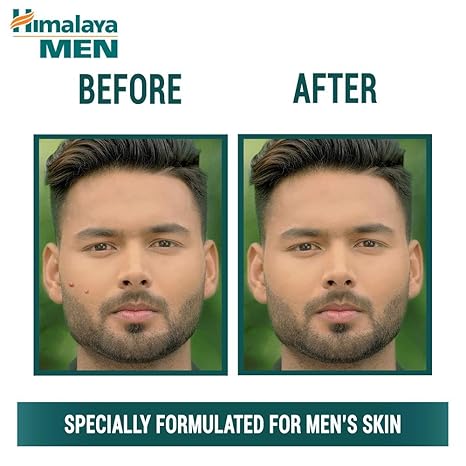 Himalaya Men Pimple Clear Neem Face Wash - PUSHMYCART