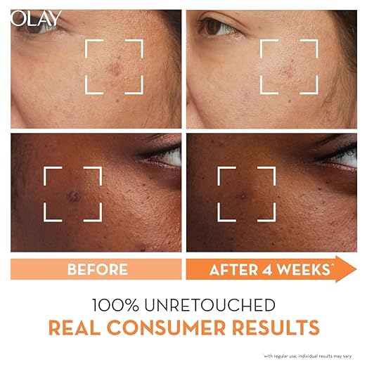 Olay Vitamin C Face Cream with Niacinamide