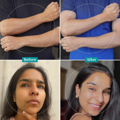 Pilgrim 25% AHA + 2% BHA + 5% PHA Peeling Solution