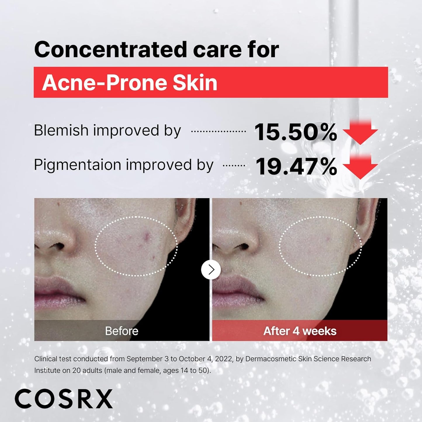 COSRX Niacinamide 15% Face Serum 