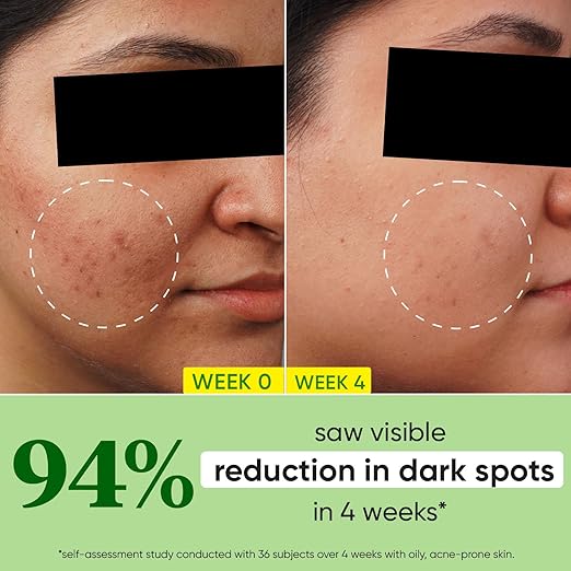 Dot & Key Cica + 10% Niacinamidе Spot Reduction Face Serum