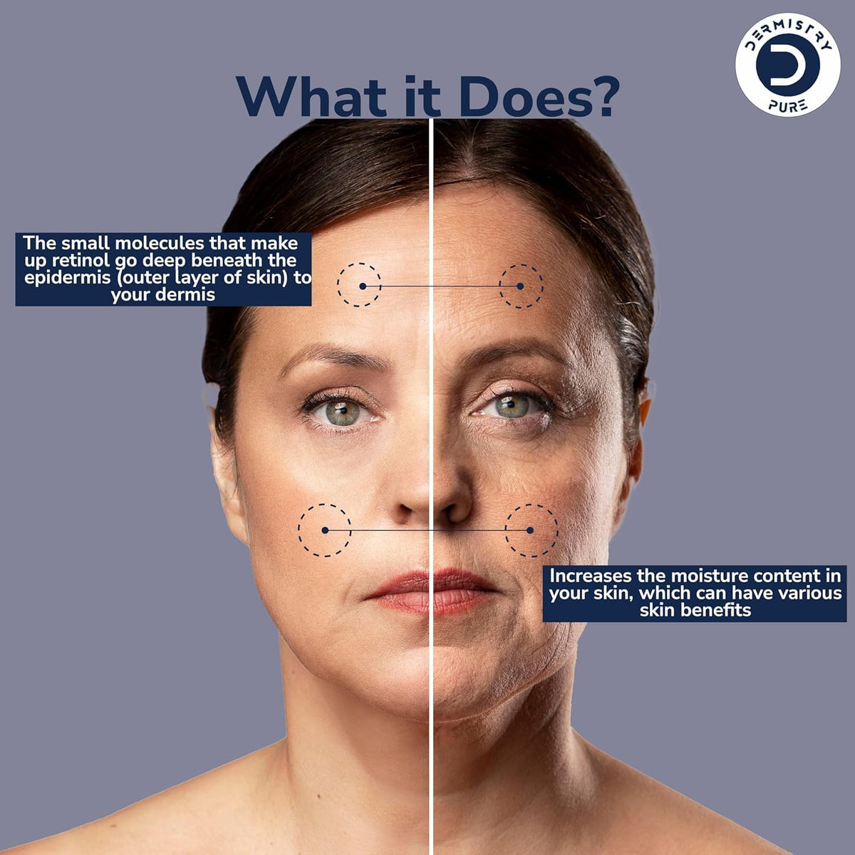 Dermistry 1% Retinol 2% Hyaluronic Acid Face Serum for Skin Care
