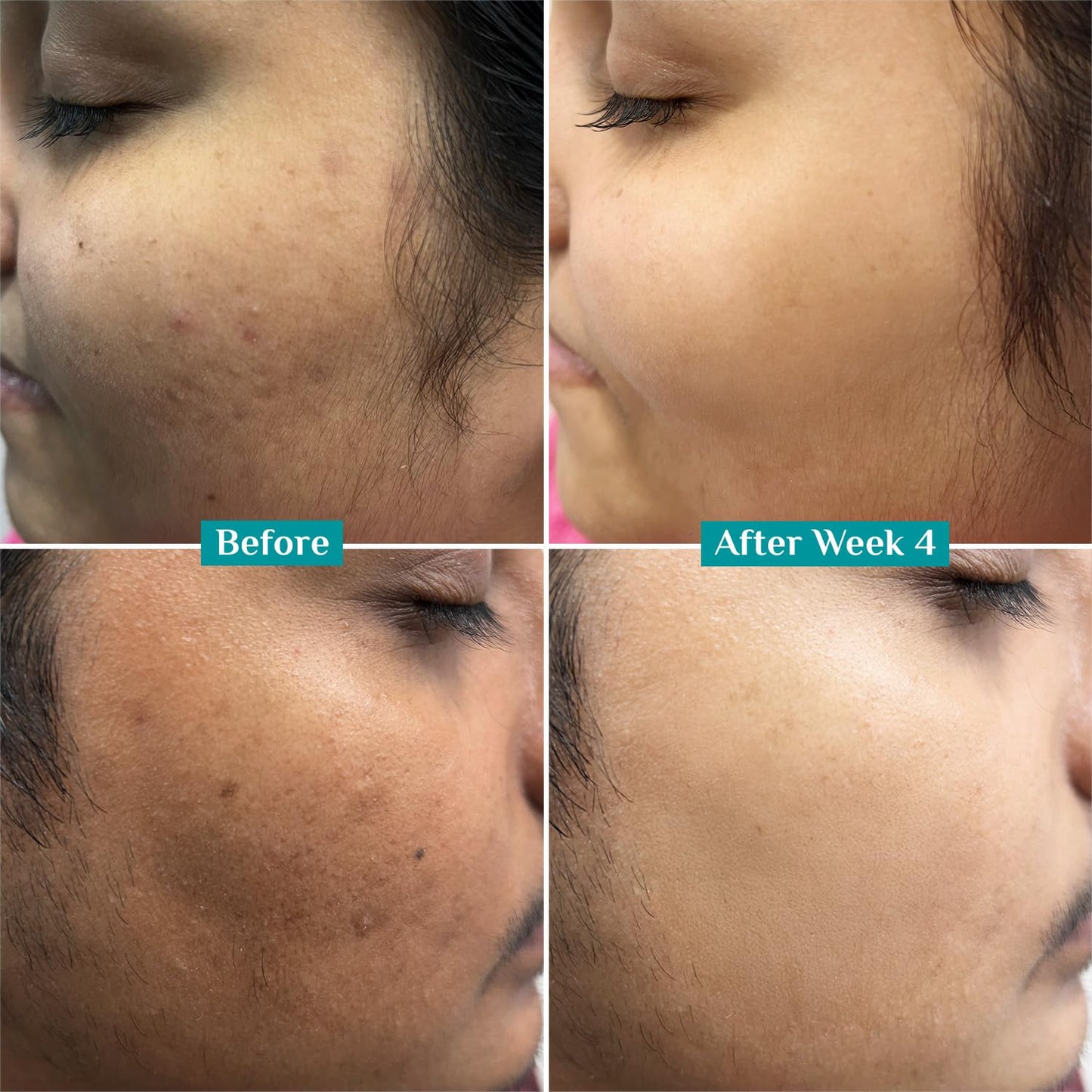 Pilgrim 10% Vitamin C Face Serum