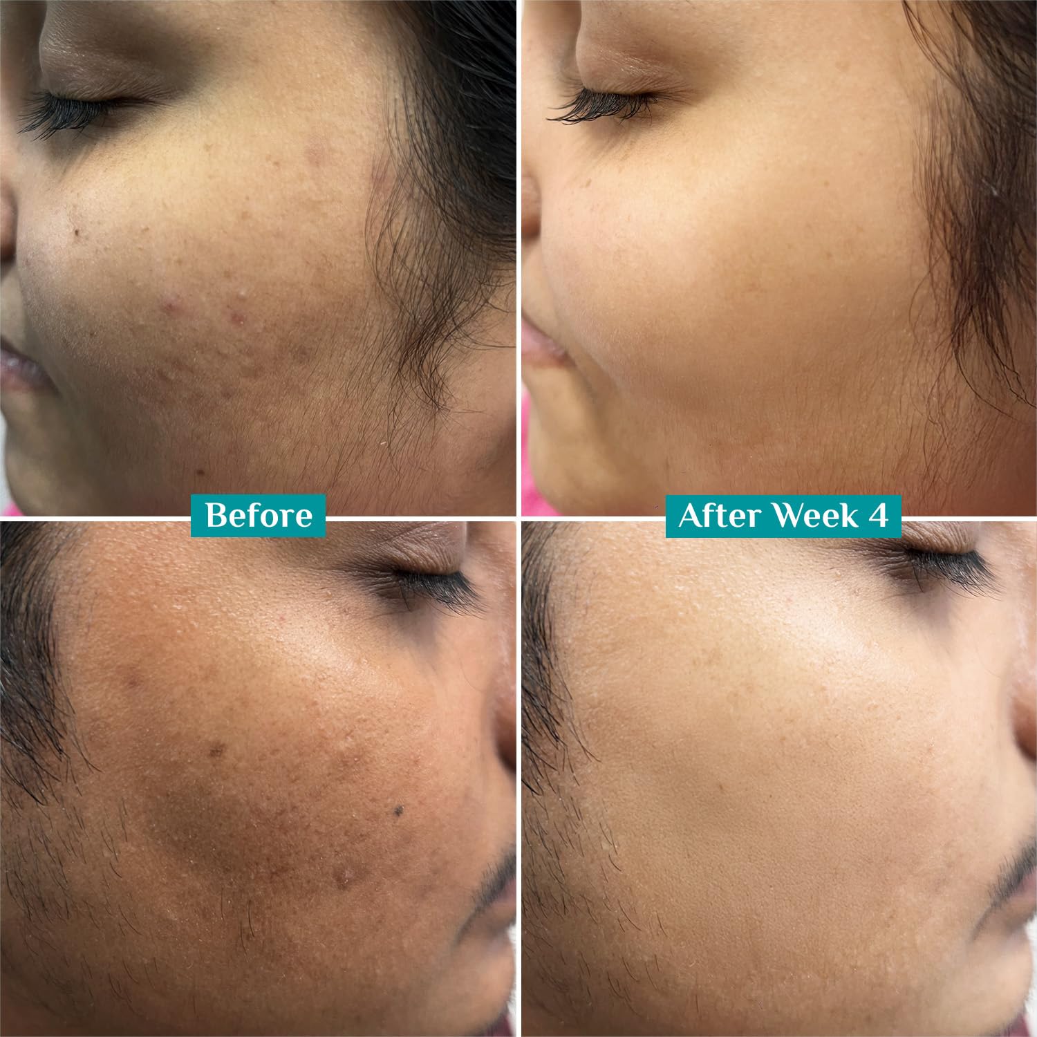Pilgrim 10% Vitamin C Face Serum