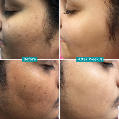 Pilgrim 10% Vitamin C Face Serum