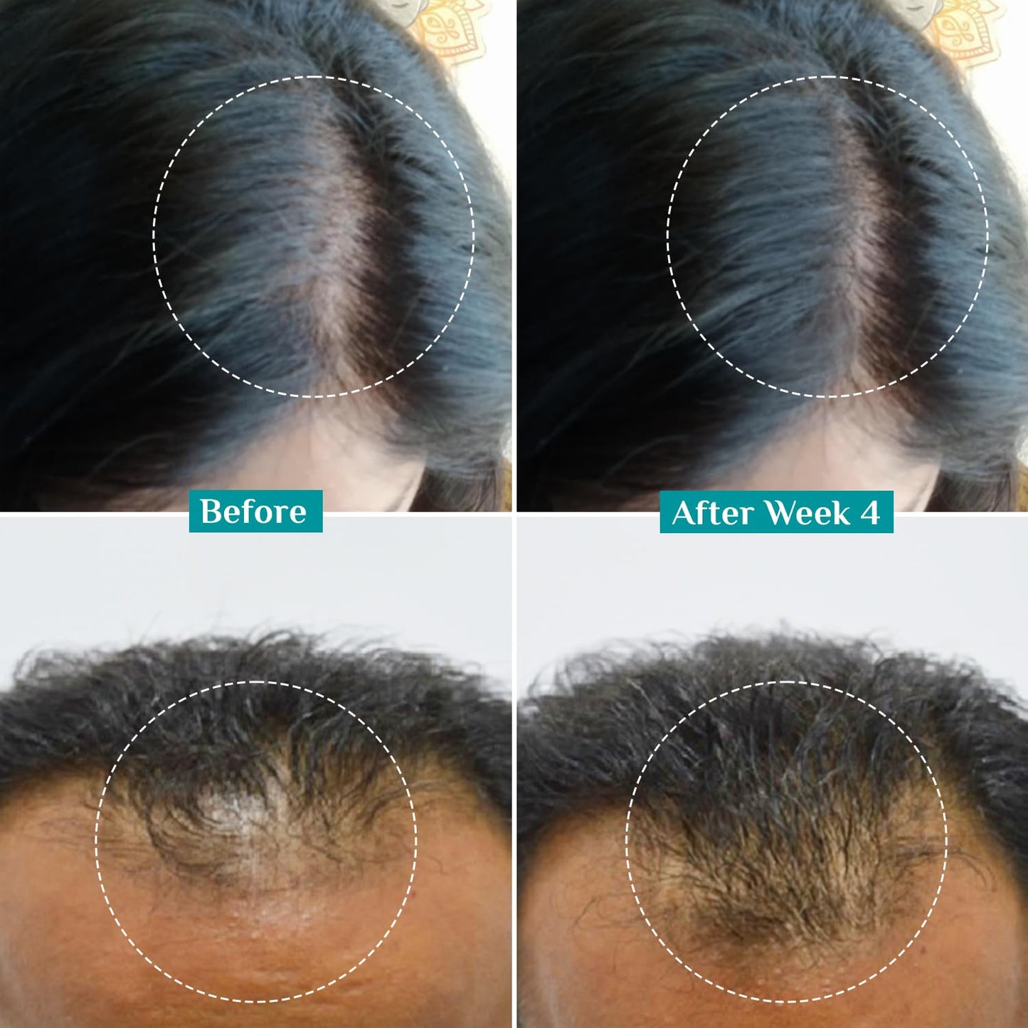 PILGRIM Redensyl 3%+Anagain 4% Advanced Hair Growth Serum