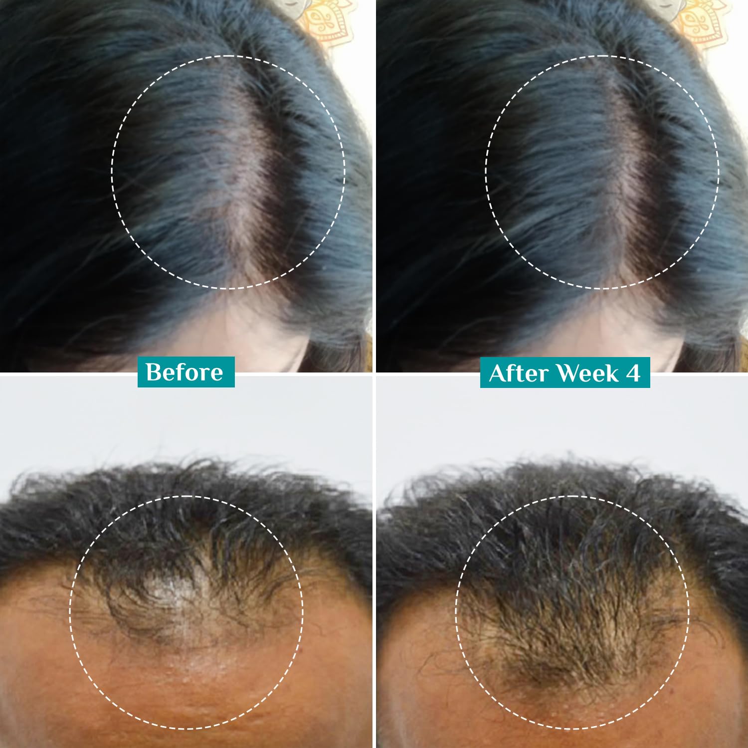 PILGRIM Redensyl 3%+Anagain 4% Advanced Hair Growth Serum