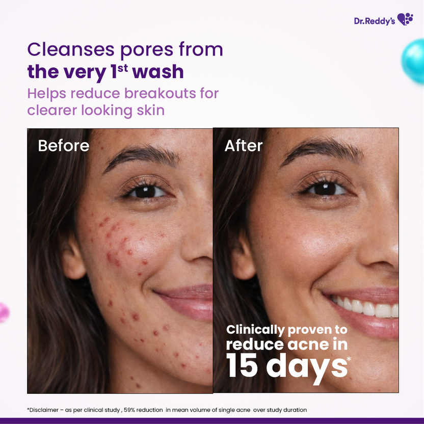 Venusia-Dr.-Reddy's-Venusia-Acne-Facewash