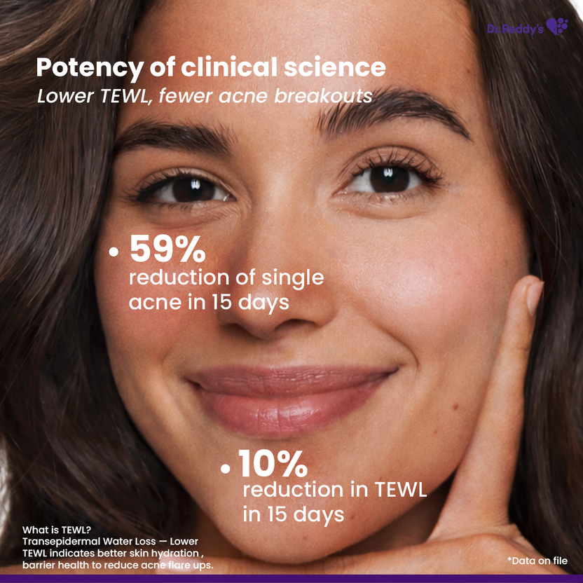 Venusia-Dr.-Reddy's-Venusia-Acne-Facewash