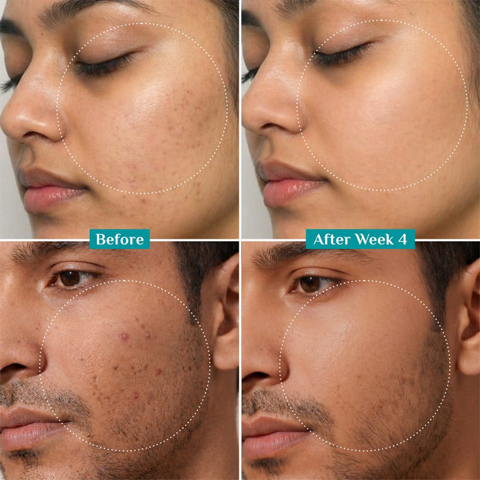 10% Niacinamide Face Serum