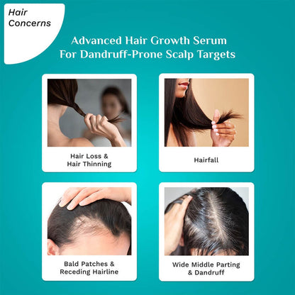 3% REDENSYL & 4%  ANAGAIN ADVANCED HAIR GROWTH SERUM FOR DANDRUFF-PRONE SCALP