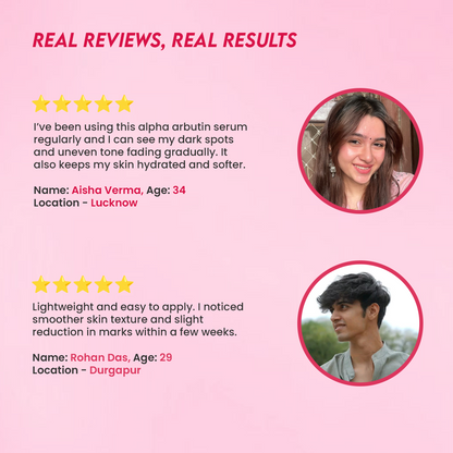 Jovees 2% Alpha Arbutin Pigmentation Cure Serum