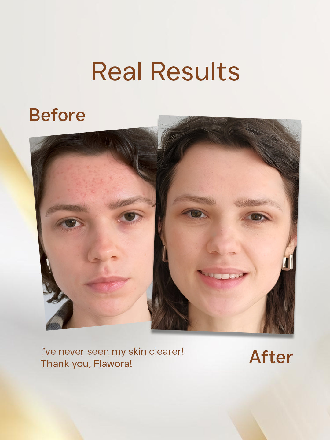 Flawora Anti Acne Serum