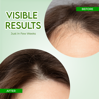 Jovees Rosemary Water Hair Growth Spray