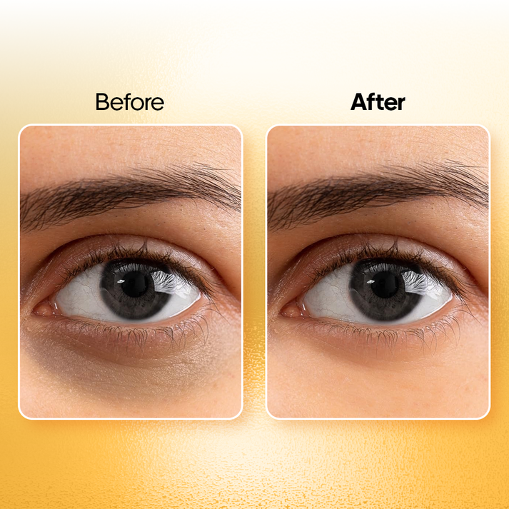 Recode-Hydrogel-Under-Eye-Patches-30-Pairs/-60-Pcs