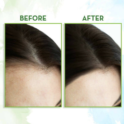 Mamaearth Rosemary Hair Growth Oil with Rosemary and Methi Dana