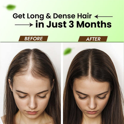 Raughan-e-Aamla Hair Oil