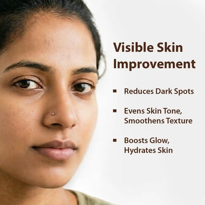 Dermistry Kojic Acid Cream for Pigmentation Removal & Bright Skin