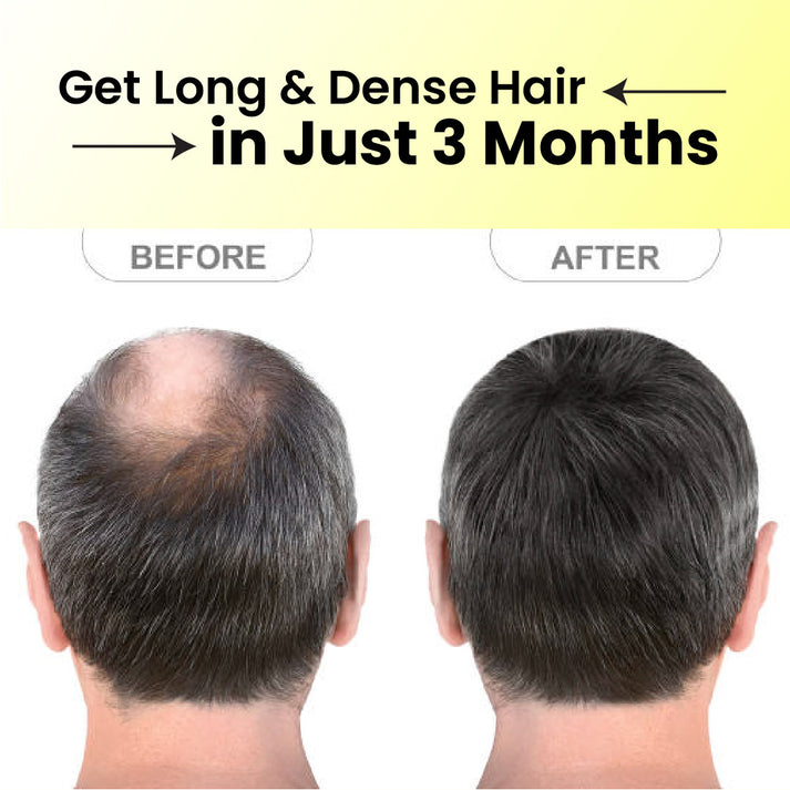 Hair & Handsome Oil