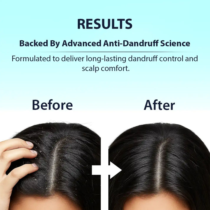 Dermistry Anti Dandruff Hair Serum treatment